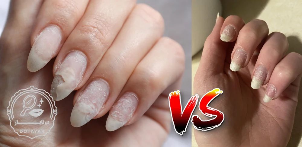 کاشت ژل بهتر است یا پودر؟ بررسی کامل تفاوت‌ها