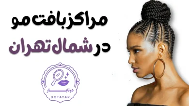 مراکز بافت مو در شمال تهران