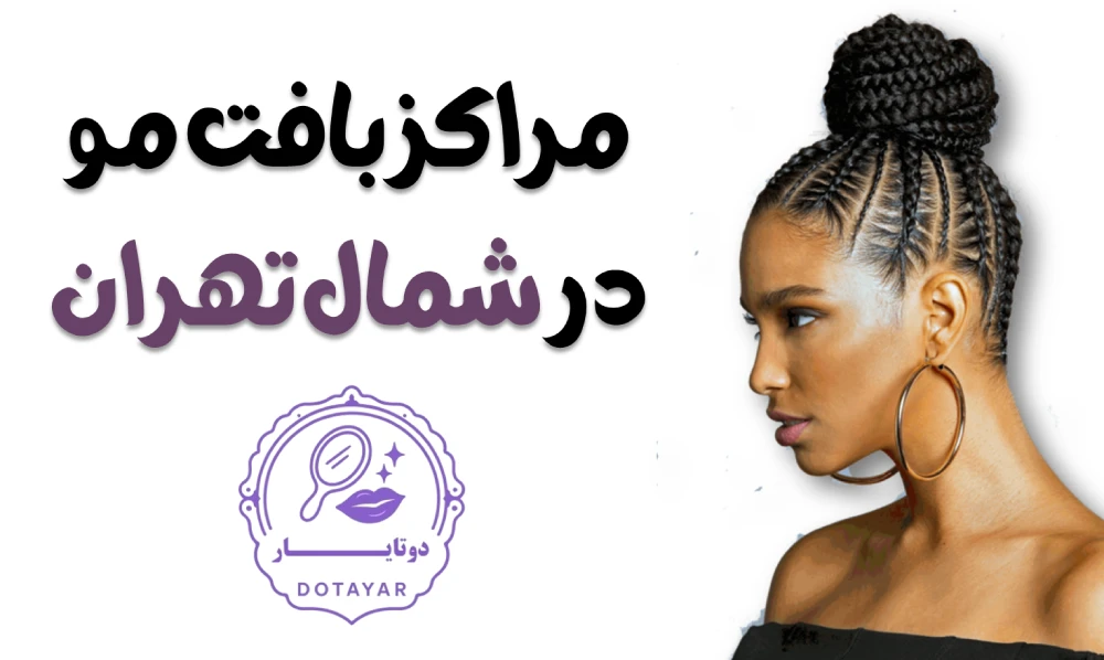 مراکز بافت مو در شمال تهران